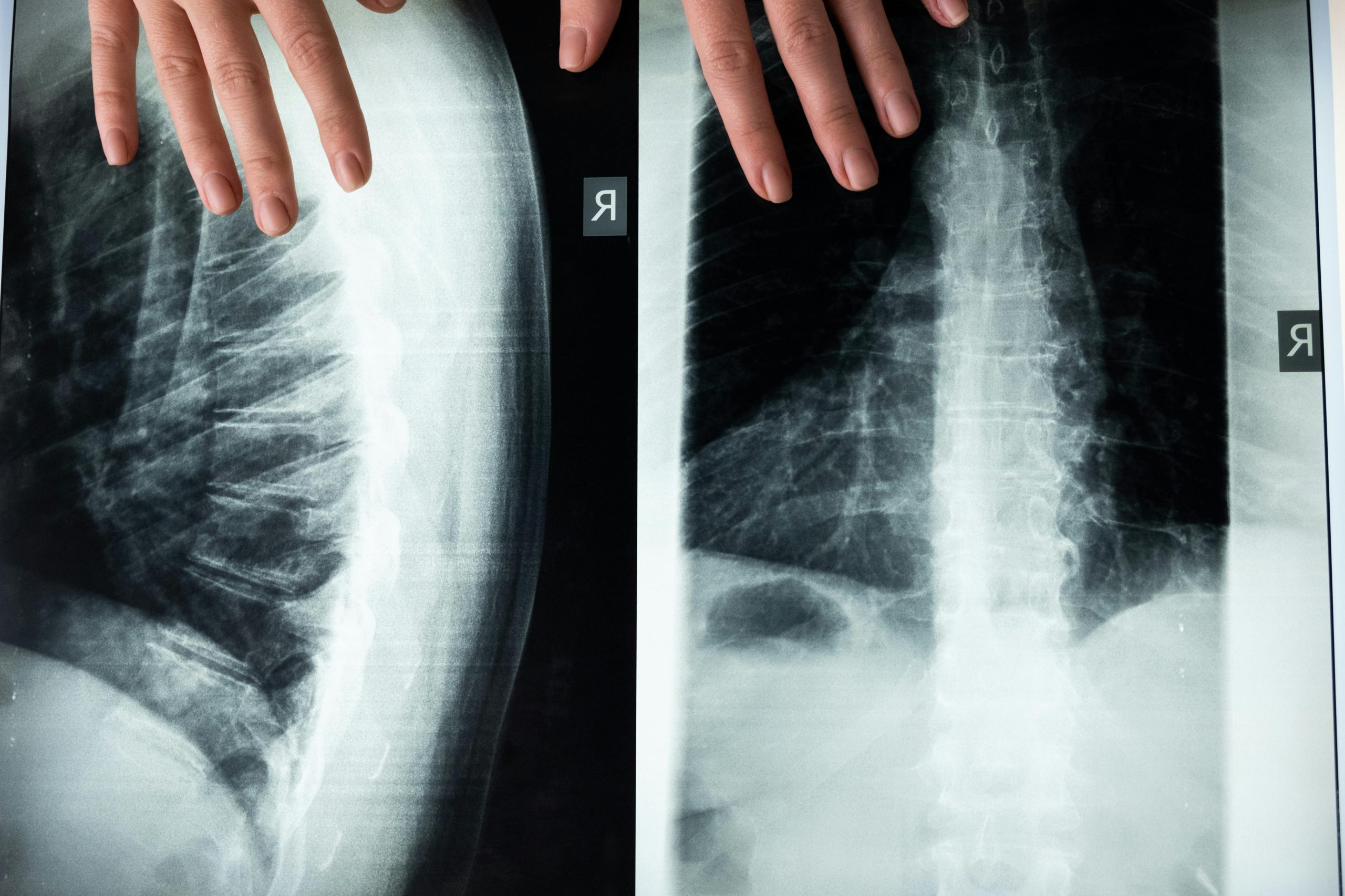 Get Immediate Results with On-Site X-Ray Fort Meade | Innovative UCC